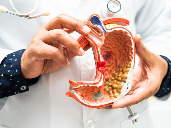 Juan Arenas, jefe del Servicio de Aparato Digestivo de Policlínica Gipuzkoa: 