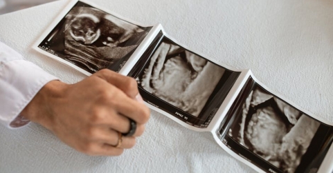 Un avance español en fertilidad muestra cambios del microbioma vaginal en 28 días 